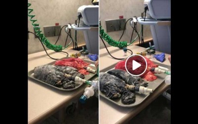 US  nurse displays on FB how healthy lungs differ from cigarette smoke-damaged ones