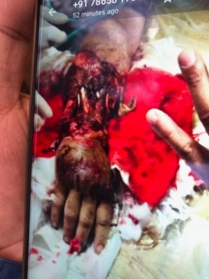 West Bengal: Communal clash breaks out in Raniganj