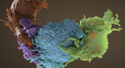 UNâ€™s AIDS agency â€˜greatly encouragedâ€™ by latest scientific breakthrough showing cure is possible