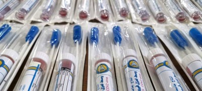 Iraq: UN health agency helps beat â€˜latest bottleneckâ€™ in COVID-19 battle