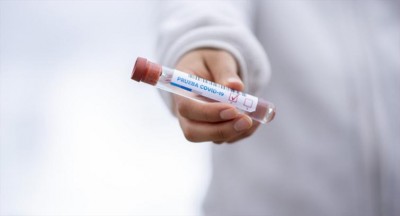 About 48 pc of Covid-19 patients in Uttar Pradesh are young men, shows data