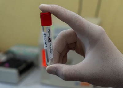 Aussie researchers repurpose SARS treatment to fight COVID-19