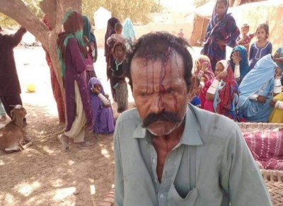 Hindu man, wife tortured in Pakistan by neighbours