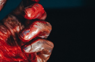 Dhaka: Chinese national stabs two Bangladeshi men