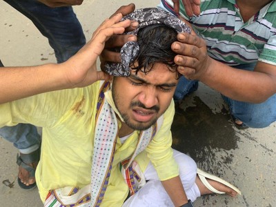 TMC youth leaders 'attacked' in Tripura, BJP blamed for the incident