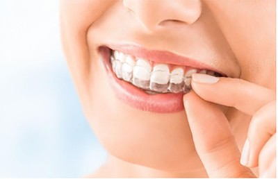Don't Let Your Misaligned Teeth Stop You from Smiling: Here's How