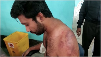 24 persons arrested for attack on junior doctor, Assam government to provide full security to doctors, health workers