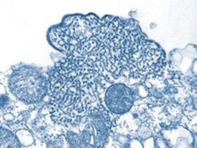 Nipah virus re-surfaces in Kerala, Tamil Nadu steps up surveillance in 9 bordering dists