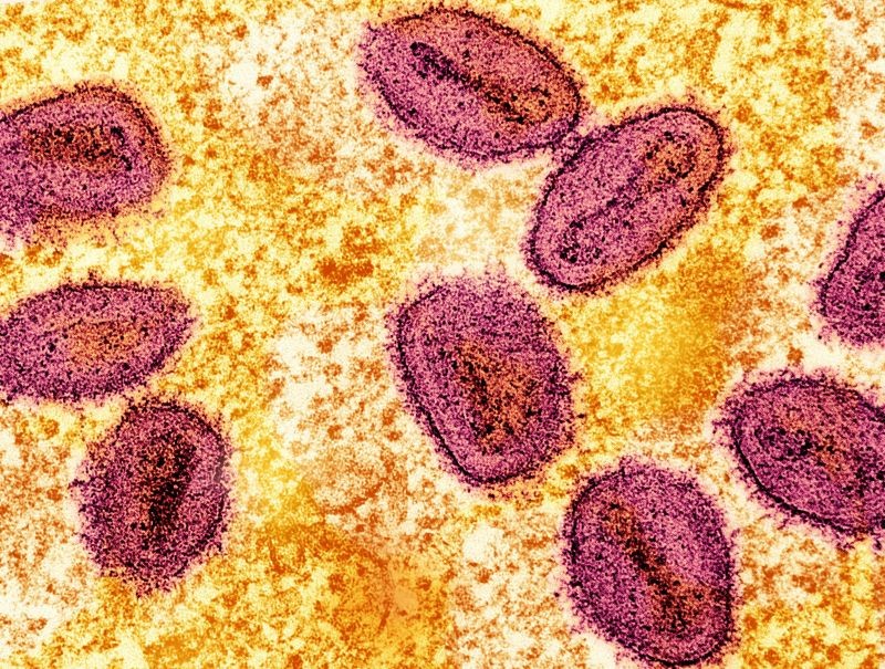 New recombinant mpox strain detected in UK and India; WHO calls for heightened surveillance