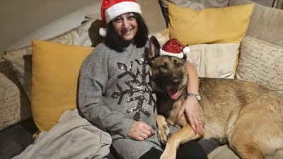 UK woman loses all four limbs to sepsis after dog’s ‘innocent’ lick turns deadly