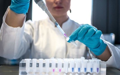 Russia investigates suspected plague death as health officials step up monitoring