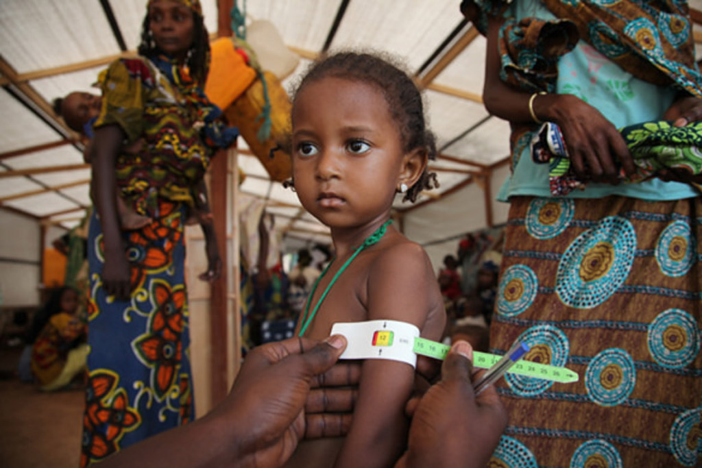 CAR: UN concerned over children suffering from malnutrition 