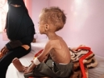 More than half a million children now risk malnutrition in Yemen: UNICEF