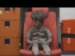 Brother of Syrian boy in haunting image dies of injuries