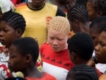 First-ever UN forum on albinism in Africa to focus on 'less talk, more action' 