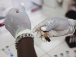 UN health agency issues new guidelines on HIV self-testing