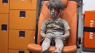 Syria conflict: Image of injured boy goes viral, receives shocked expressions