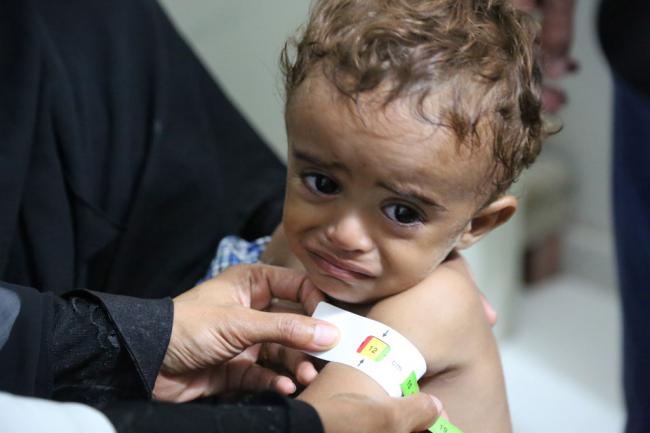 'An entire generation could be crippled by hunger' in Yemen â€“ UN food relief agency