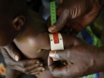DR Congoâ€™s economy loses over $1 billion to child undernutrition, finds UN-backed study