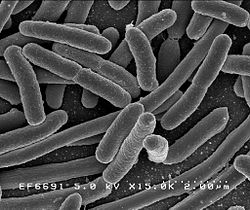 Canada: Risk of E. coli prompts CFIA to recall Robin Hood all-purpose flour