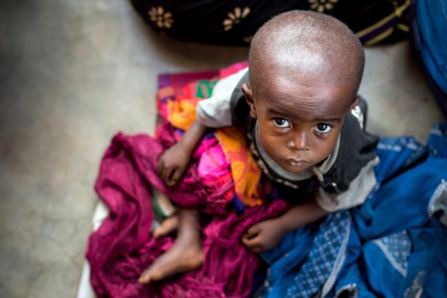 DR Congo: 400,000 children in Greater Kasai at risk of severe acute malnutrition, UNICEF warns