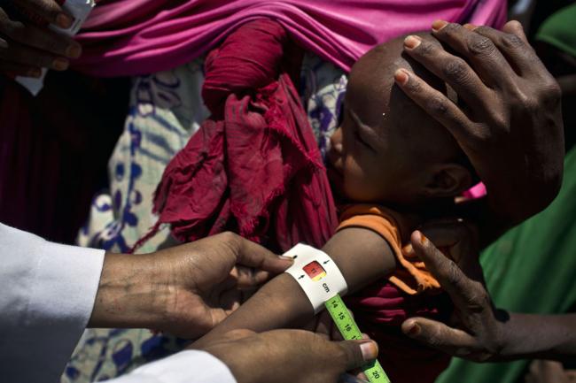 As famine looms, malnutrition and disease rise sharply among Somali children â€“ UNICEF