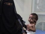 Looming famine in Yemen could put two million mothers at risk of death â€“ UN agency