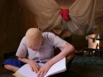 â€˜Much moreâ€™ can be done to raise awareness about the plight of persons with albinism: UN chief