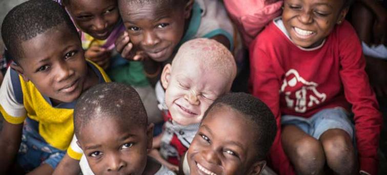 Recognize, celebrate and â€˜stand in solidarityâ€™ with persons with albinism