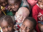 Recognize, celebrate and â€˜stand in solidarityâ€™ with persons with albinism