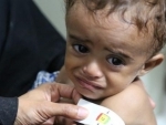 Dozens killed and injured by new airstrikes in western Yemen, UN coordinator condemns â€˜outrageousâ€™ toll