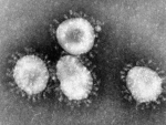 Egypt confirms 3rd case of novel coronavirus: ministry