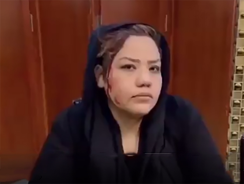 Afghan woman activist thrashed by Taliban for seeking political rights: Report