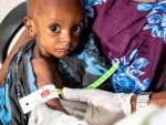 Global hunger crisis pushing one child per minute, into severe malnutrition
